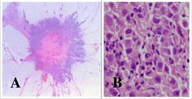 Fig 5-14 PILC low and high power