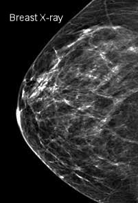 Types of breast  Breast, Asymetrical, Warner's