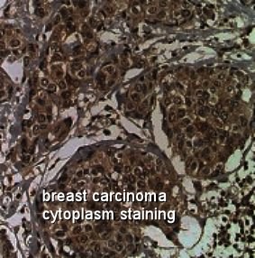 Cytoplasm, organelles golgi lysosomes - by Moose and Doc