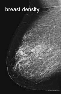 Breast Density Chart