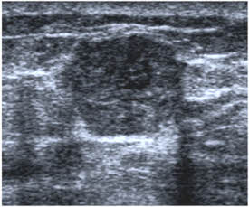 Mammogram Images and Ultrasound Explained by Moose and Doc