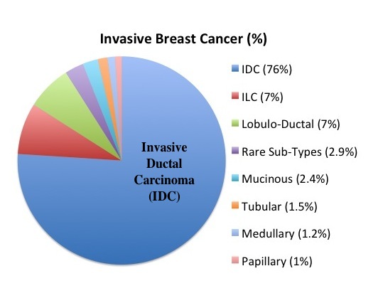 Breast Cancer Types Chart